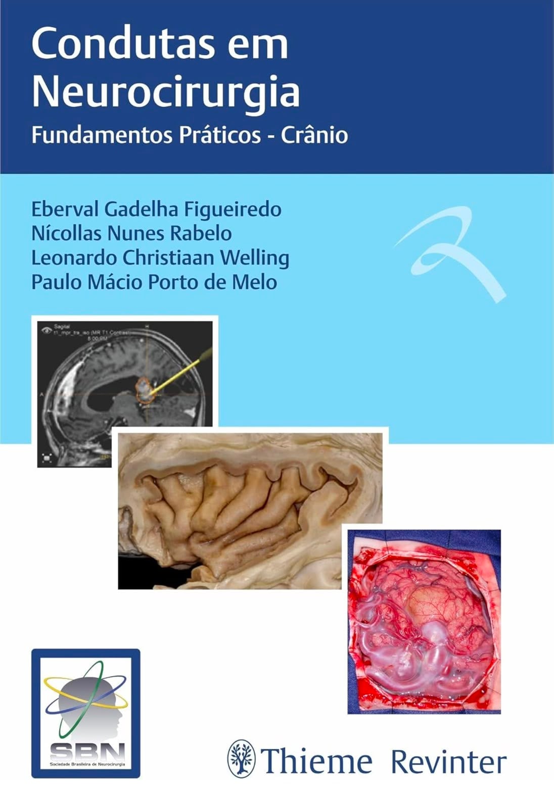 Livro Condutas em Neurocirurgia, Crânio